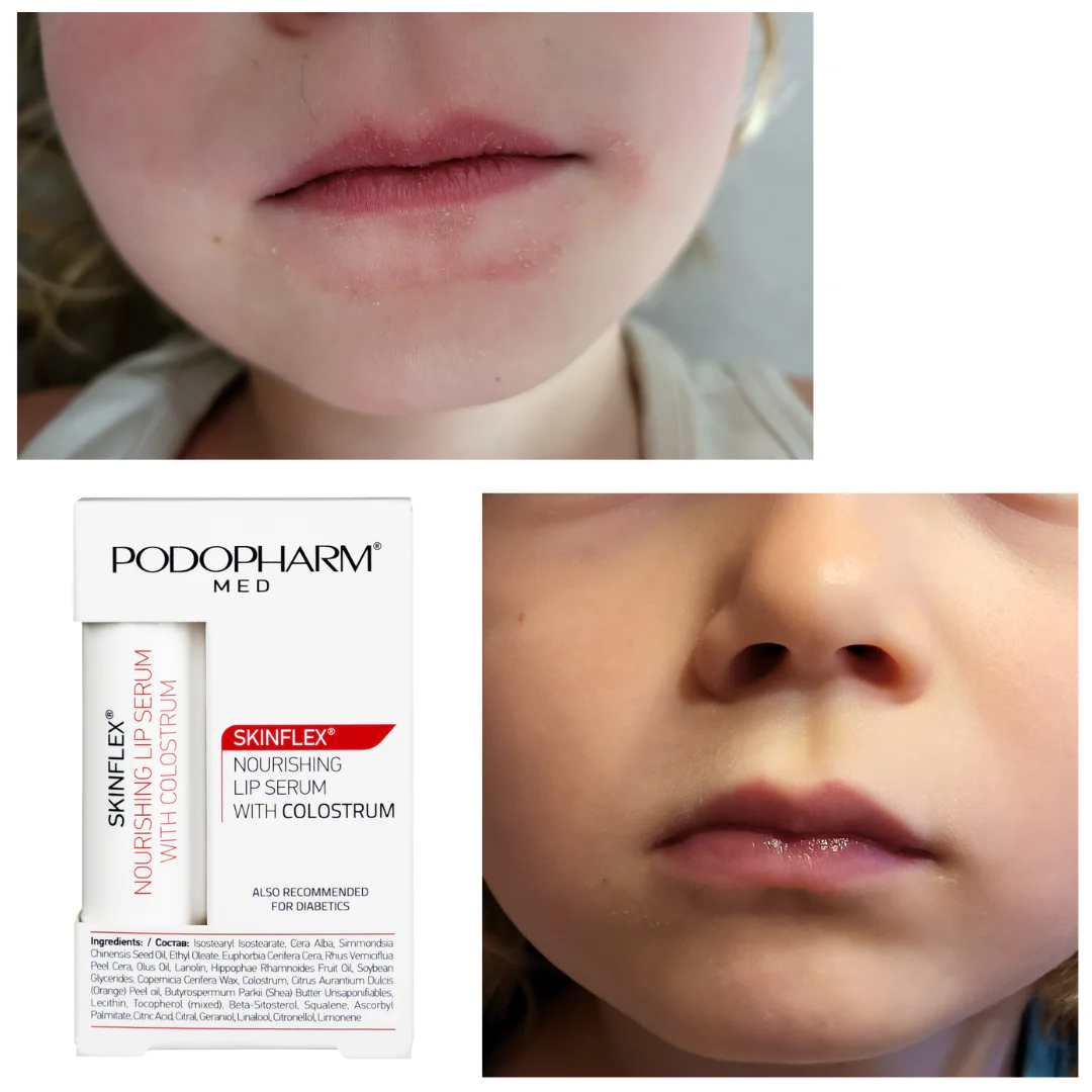 Podopharm LIP SERUM WITH COLOSTRUM, TOITEV HUULEPALSAM TERNESPIIMAGA 4,9G - Image 3