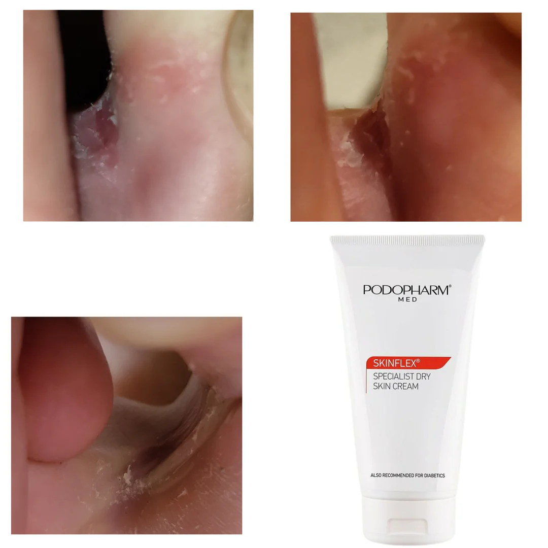 Podopharm SPECIALIST DRY SKIN CREAM, SPETSIAALNE KUIVA NAHA KREEM 150ML - Image 4