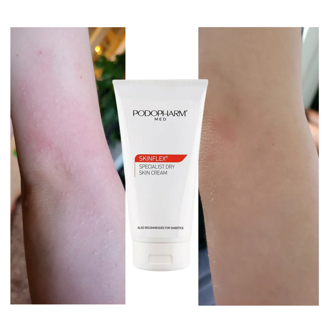 Podopharm SPECIALIST DRY SKIN CREAM, SPETSIAALNE KUIVA NAHA KREEM 150ML - Image 3