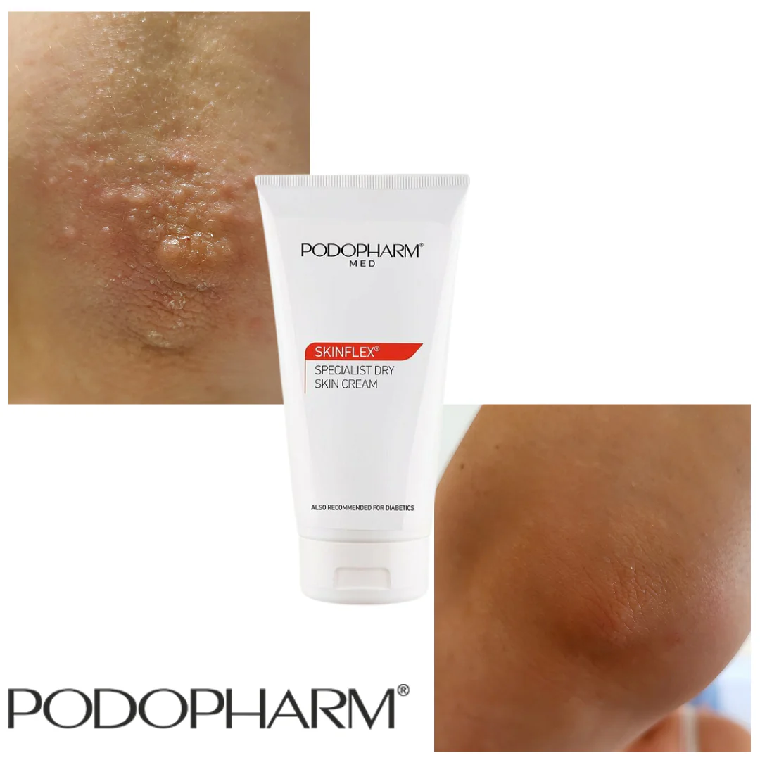 Podopharm SPECIALIST DRY SKIN CREAM, SPETSIAALNE KUIVA NAHA KREEM 150ML - Image 2