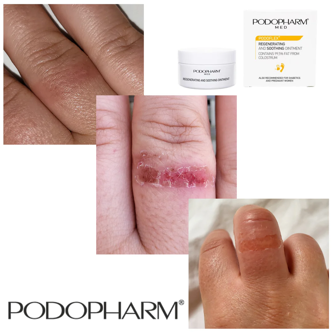 Podopharm REGENERATING AND SOOTHING OINTMENT, TERNESPIIMASALV 60MLkanda kahjustunud kohale vastavalt vajadusele. - Image 3